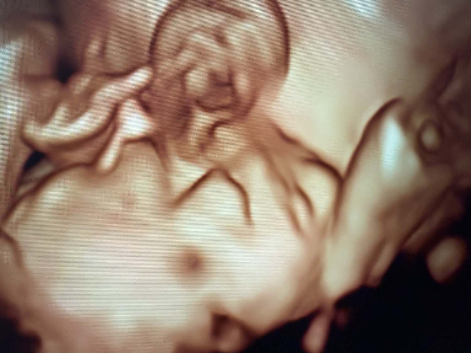 Pregnancy Scan - I Saw You First Imaging, LLC